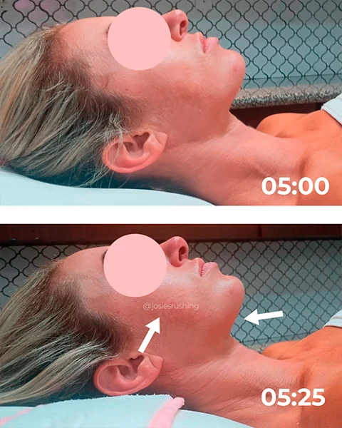 Before-and-after-10.webp