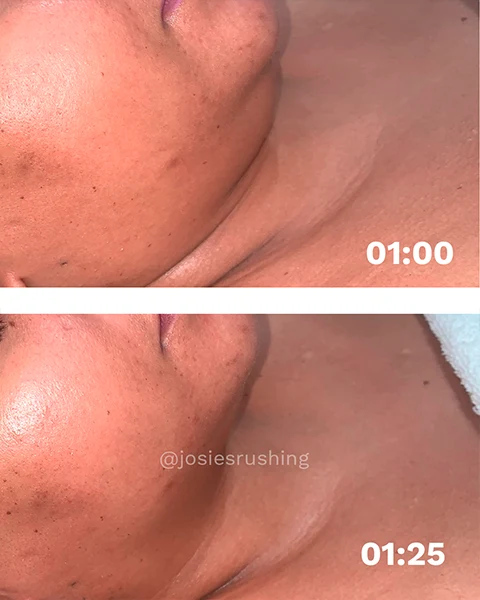 Before-and-after-11.webp