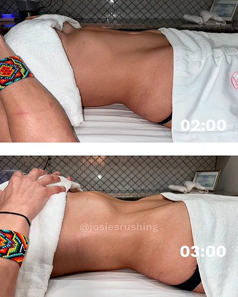 Before-and-after-2.webp