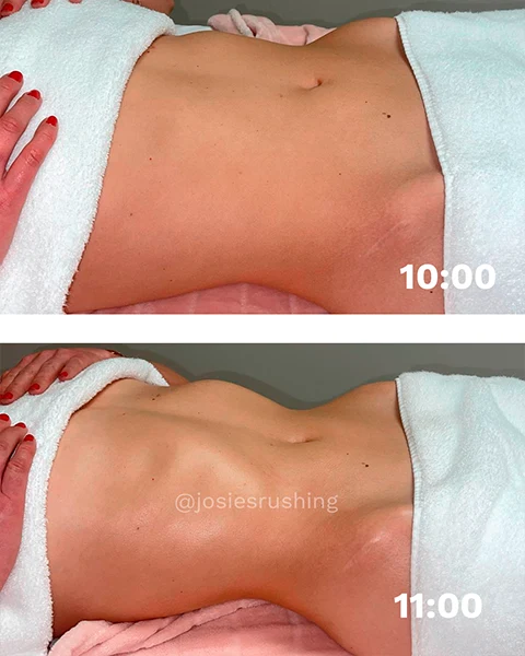 Before-and-after-3.webp