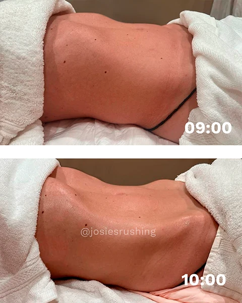 Before-and-after-4.webp