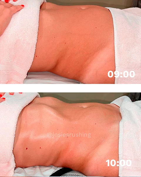 Before-and-after-6.webp